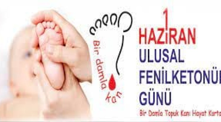 “Fenilketonüri kalıtsal metabolik bir hastalıktır”