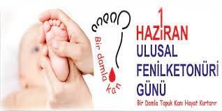 “Fenilketonüri kalıtsal metabolik bir hastalıktır”